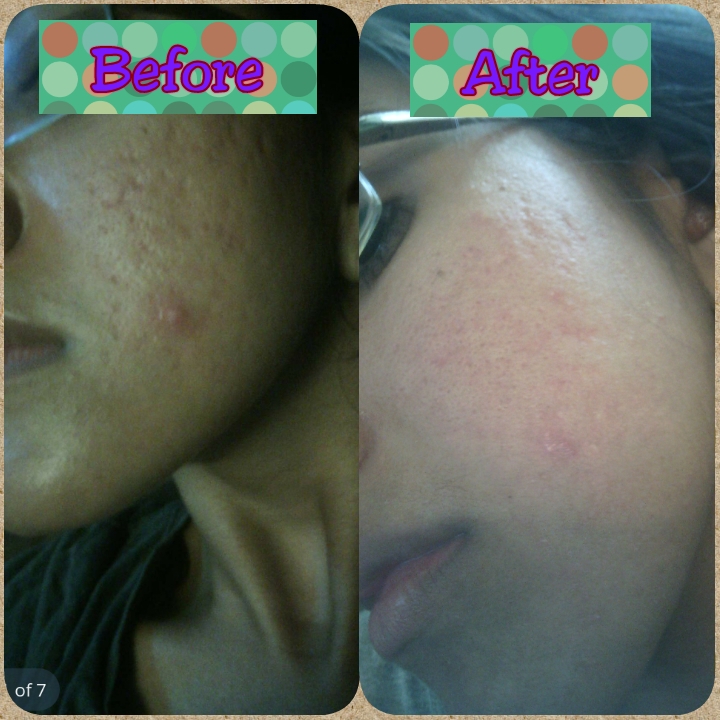 PhotoGrid_1441962027632.jpg image