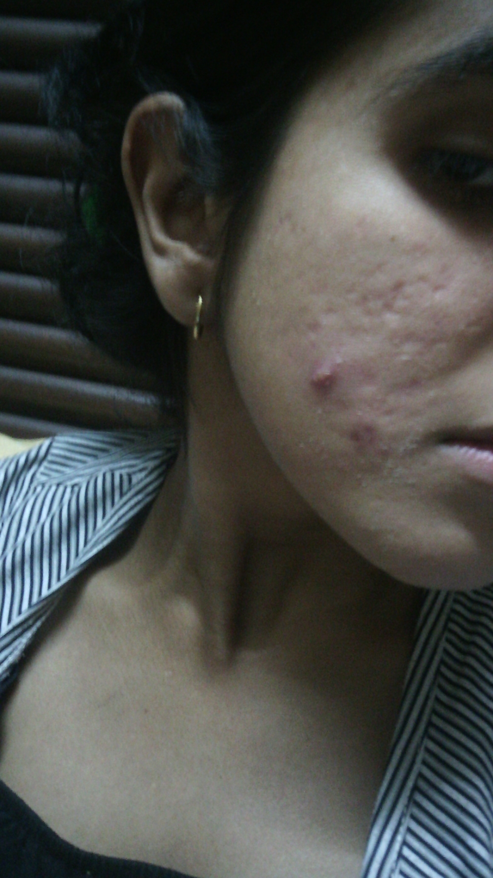 IMG_20151219_205649.jpg image